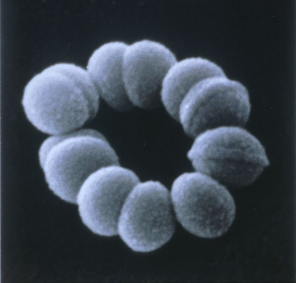 Infection à Streptococcus pyogenes. Agent pathogène - Base de données ...