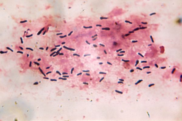 Bacille dyphtérique (Corynébacterium diphtériae)
