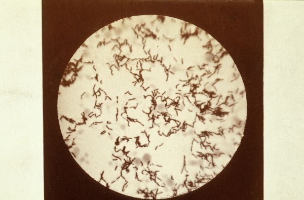 Bacille du Rouget (Erysipelothrix rhusiopathiae)