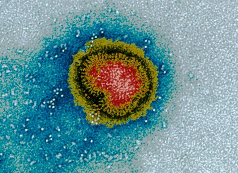 Virus de la grippe (Virus influenza)