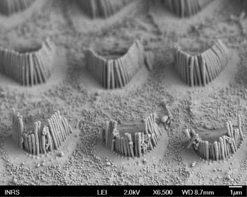 Vue au microscope électronique à balayage de cellules ciliées de rat (cellules sensorielles recouvrant la surface de la cochlée), dont les stéréocils ont été endommagés (au premier plan) par une coexposition au disulfure de carbone et au bruit