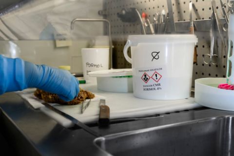 Récupération dans une unité de biopsie de déchets liquides nocifs CMR à base de formaldéhyde