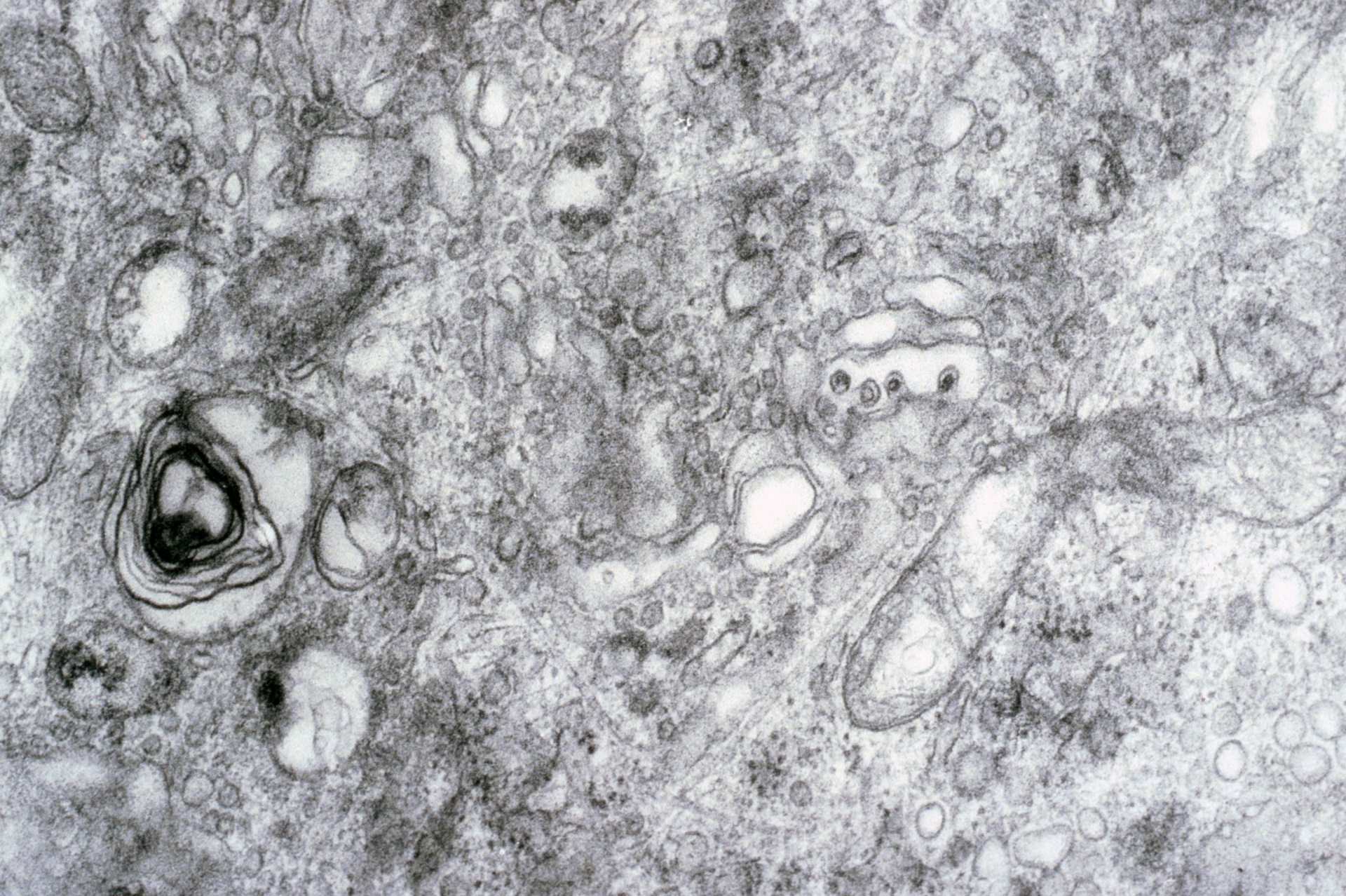 Rubéole. Agent pathogène - Base de données EFICATT - INRS