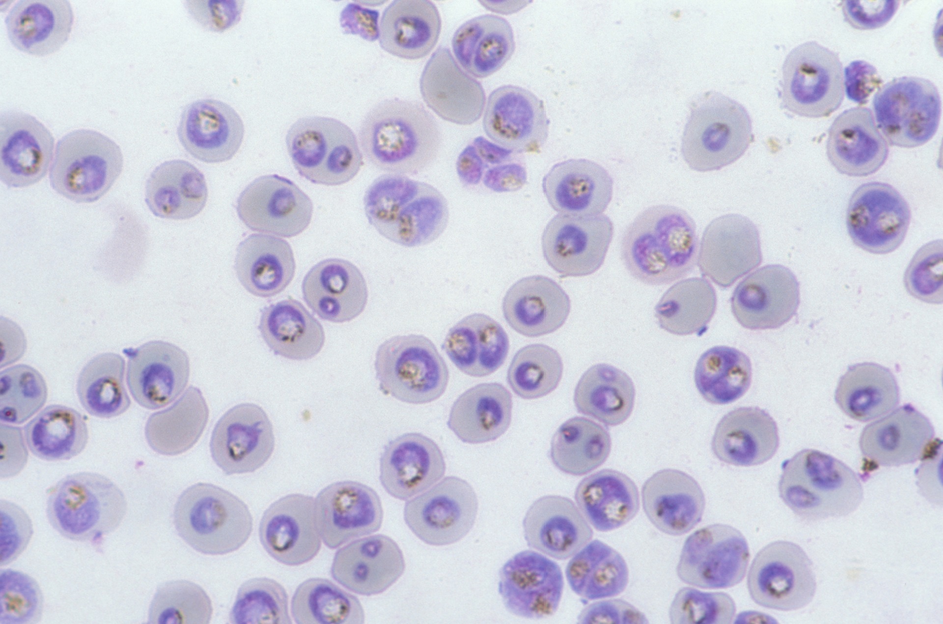 malária plazmodium